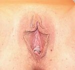 Transgender Vagina Natural Vagina Free Download Nude Photo G